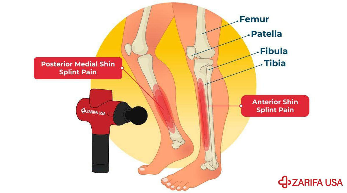 Massage Gun for Shin Splints