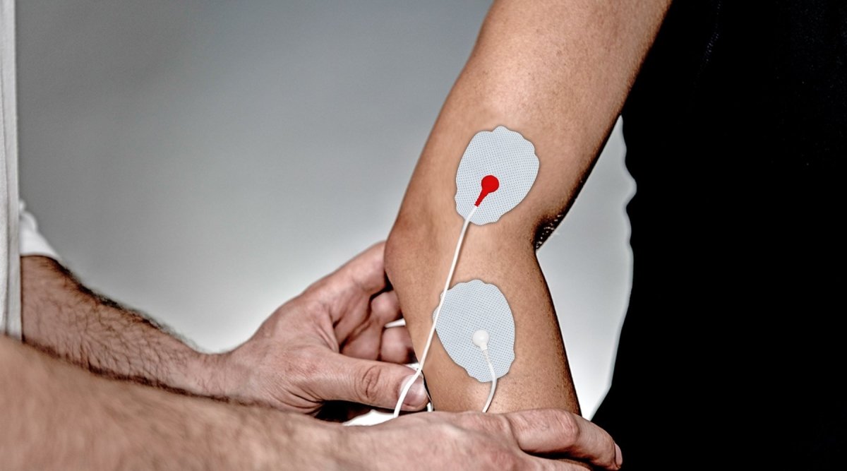 Tens Unit for Tennis Elbow | FDA Approved | HSA or FSA Eligible