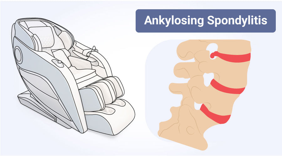 Comprehensive Guide to Using Massage Chairs for Ankylosing Spondylitis