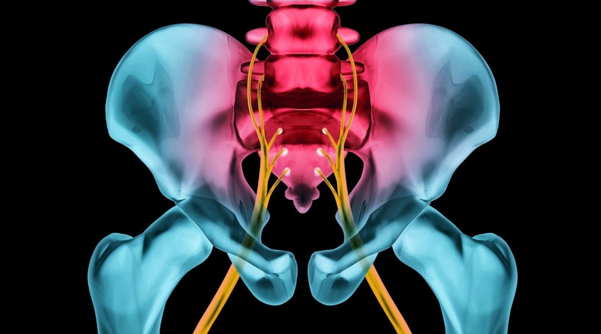 HOW TO TREAT YOUR SCIATICA | Zarifa USA